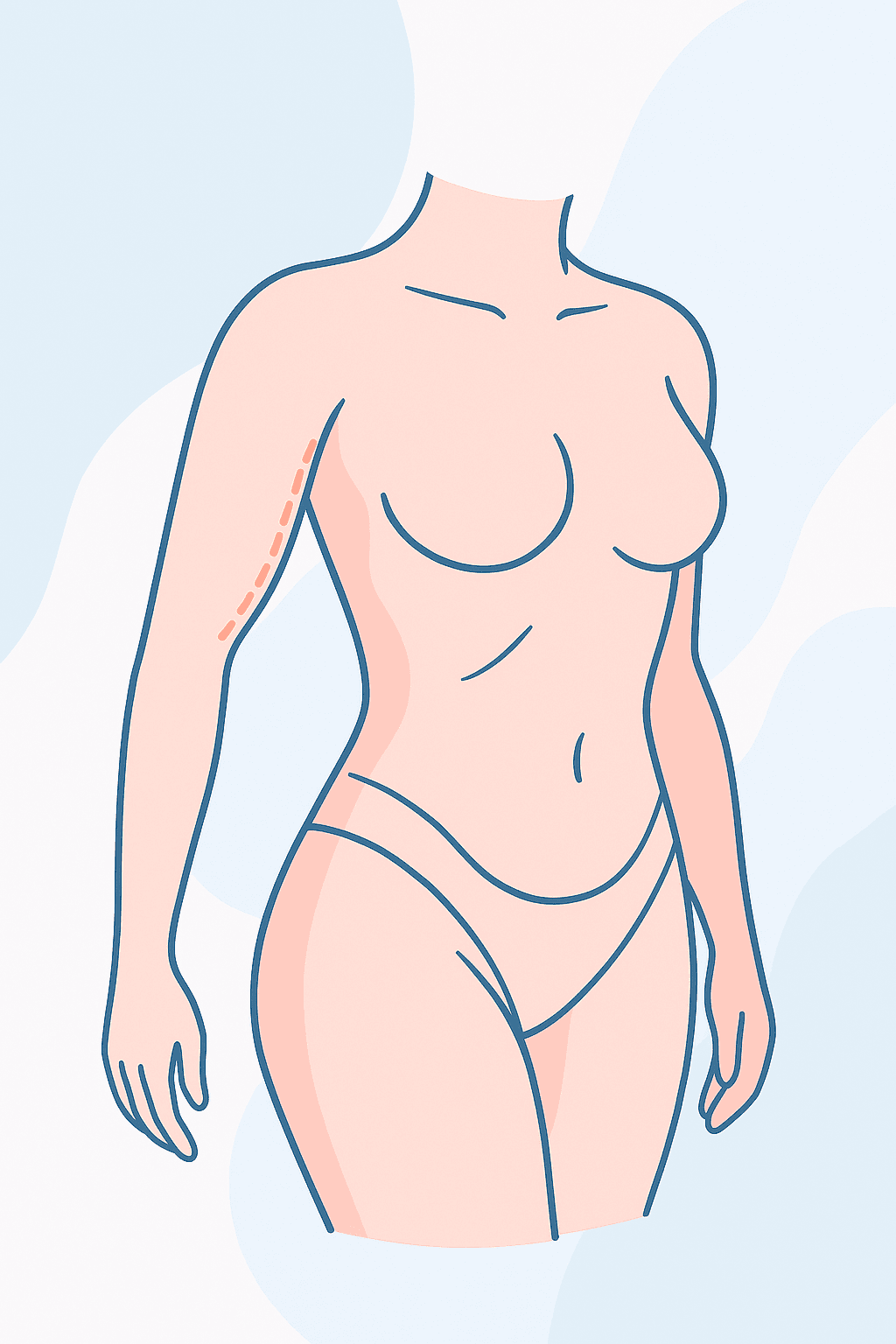 procedure expectations