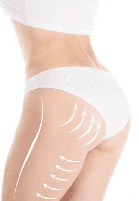 procedure expectations