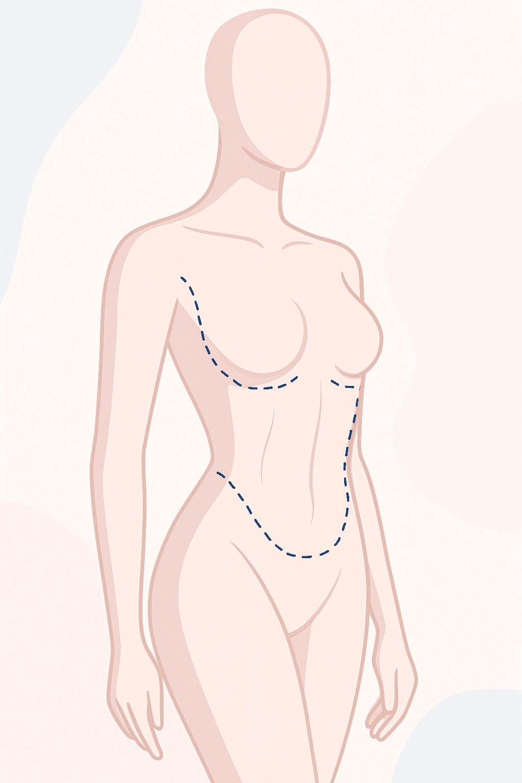 procedure expectations