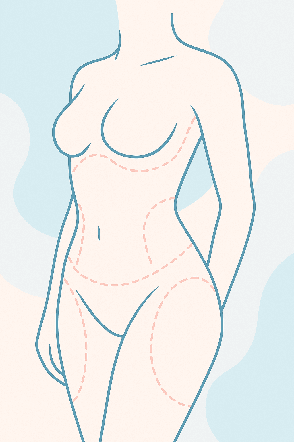 procedure expectations