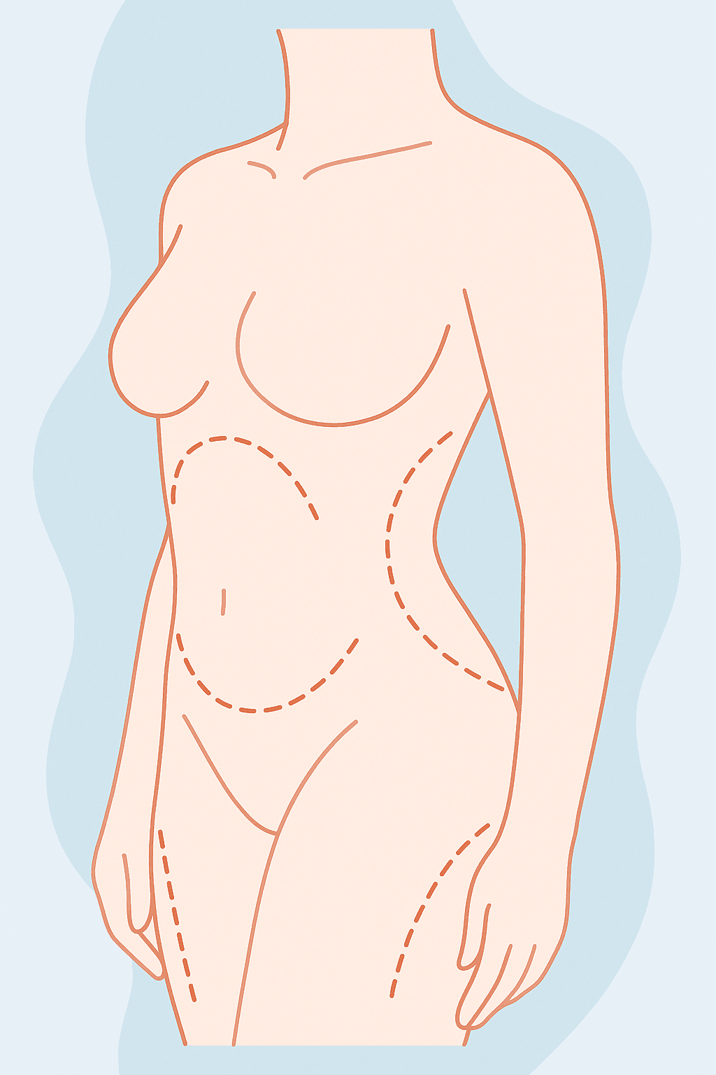 procedure expectations