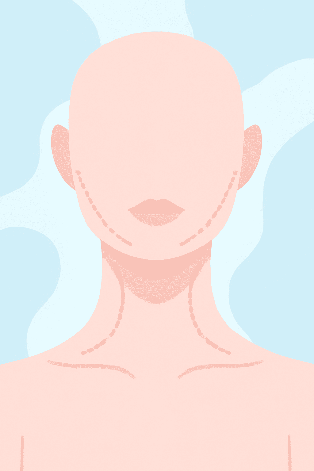 procedure expectations