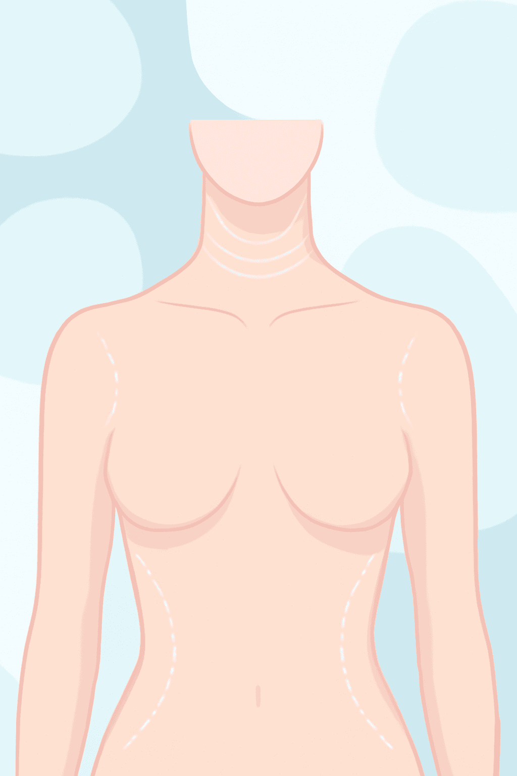 procedure expectations