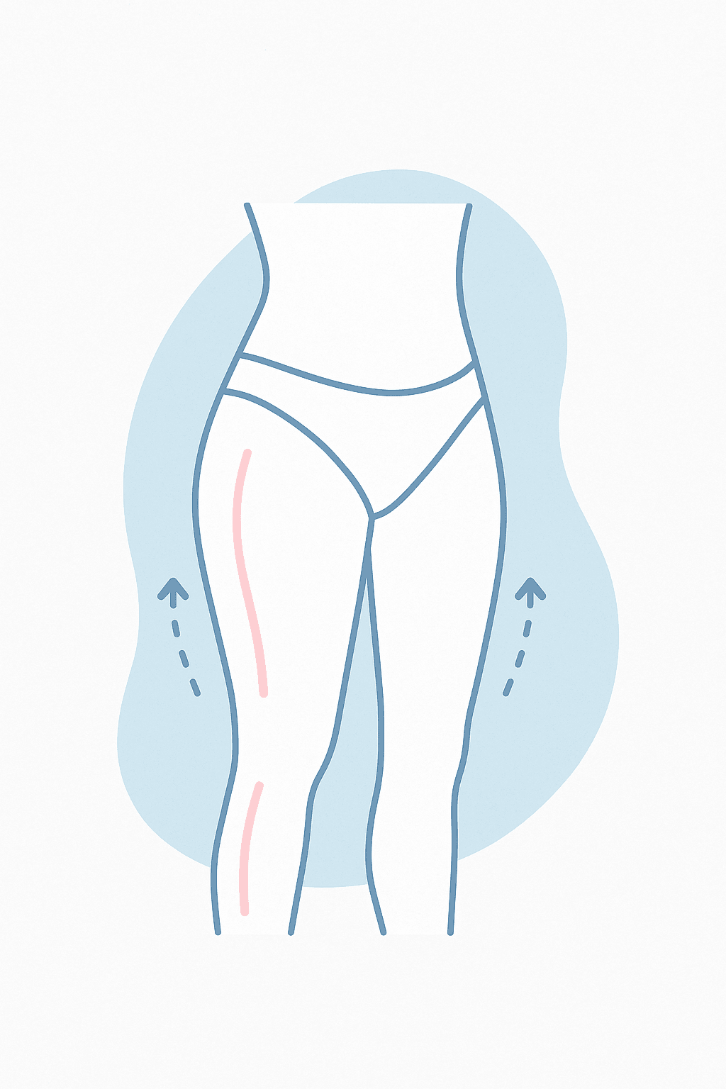 procedure expectations