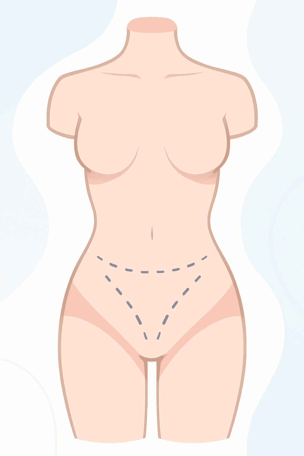 procedure expectations