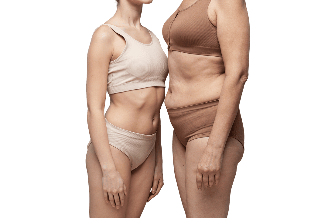 Lipo 360 Before and After: Real Patient Results from Miami (2025 Guide)