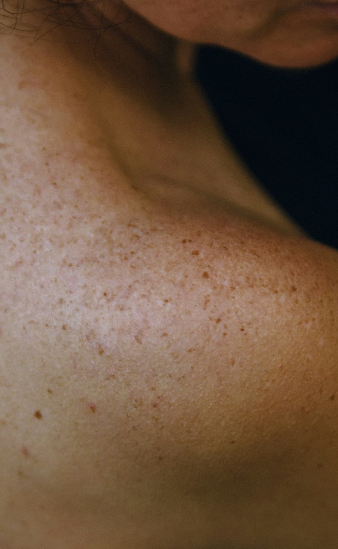 Best Skin Tightening Surgeons in Chicago (2025 Guide)