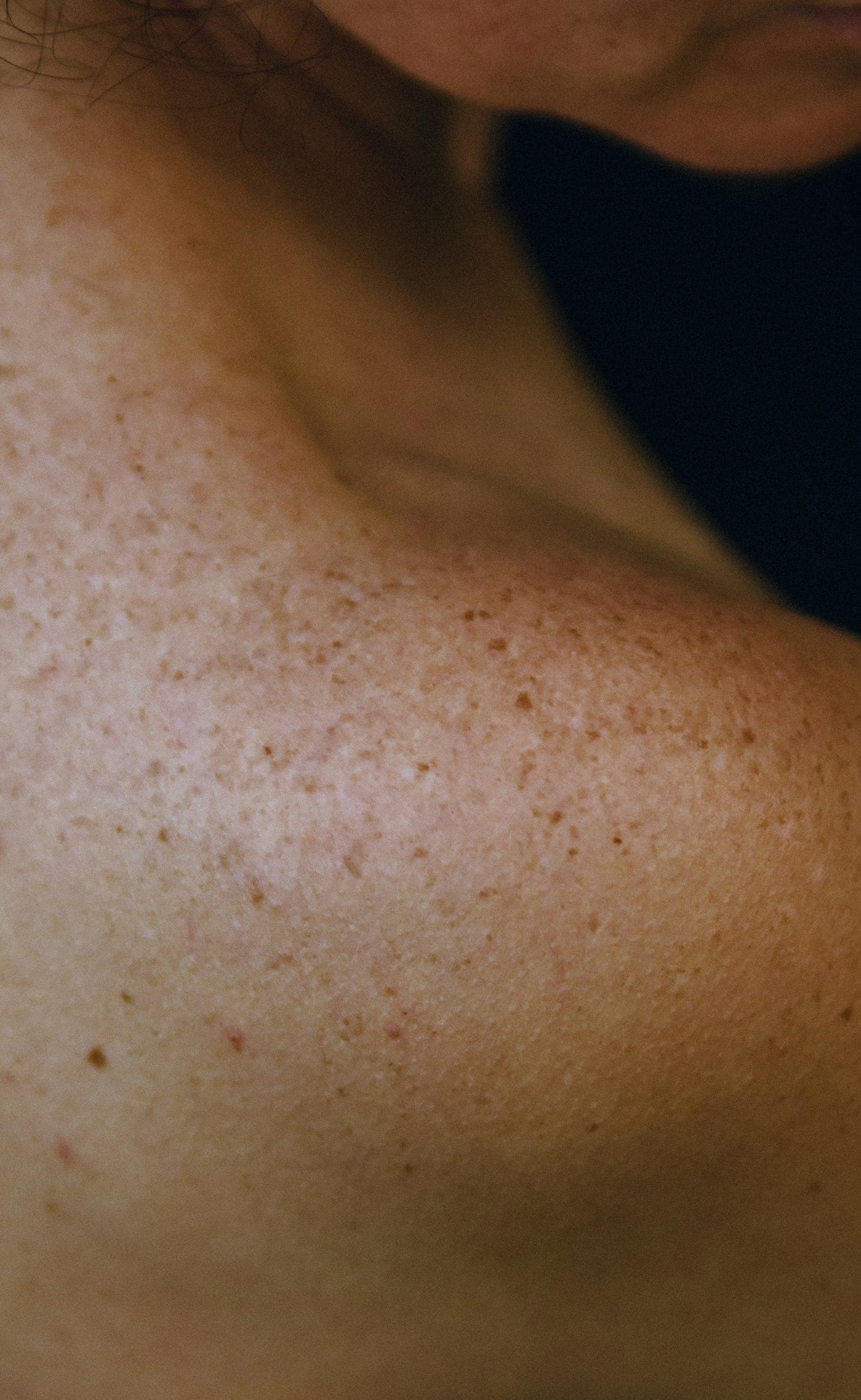 Best Skin Tightening Surgeons in Chicago (2025 Guide)