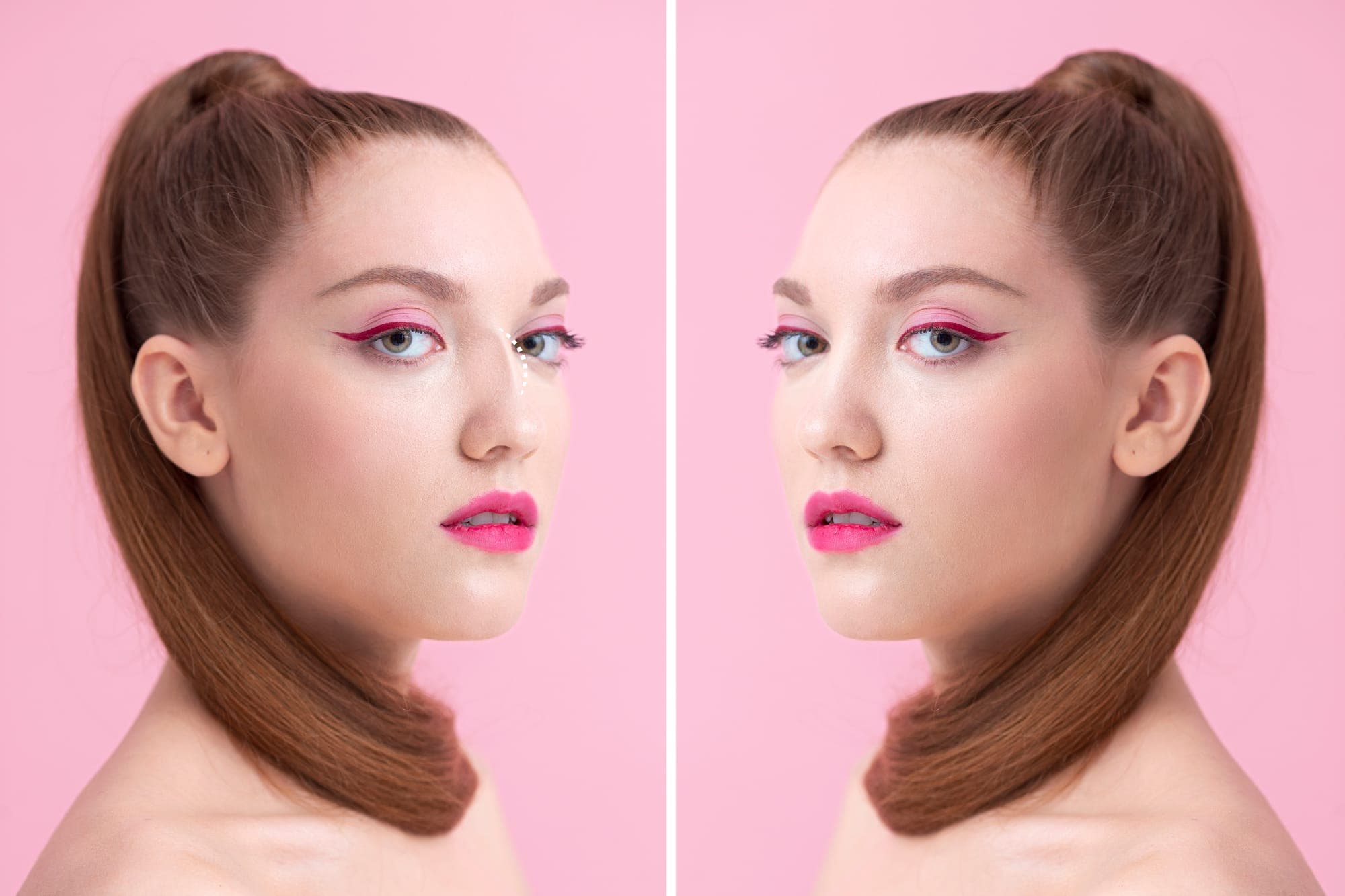 Rhinoplasty Before and After in Austin: What to Expect