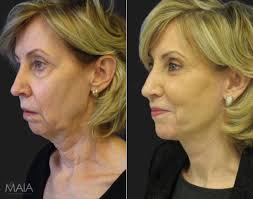 Hip Enhancement procedure image